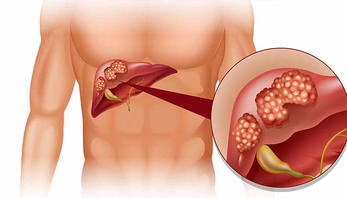 Liver Function Tests